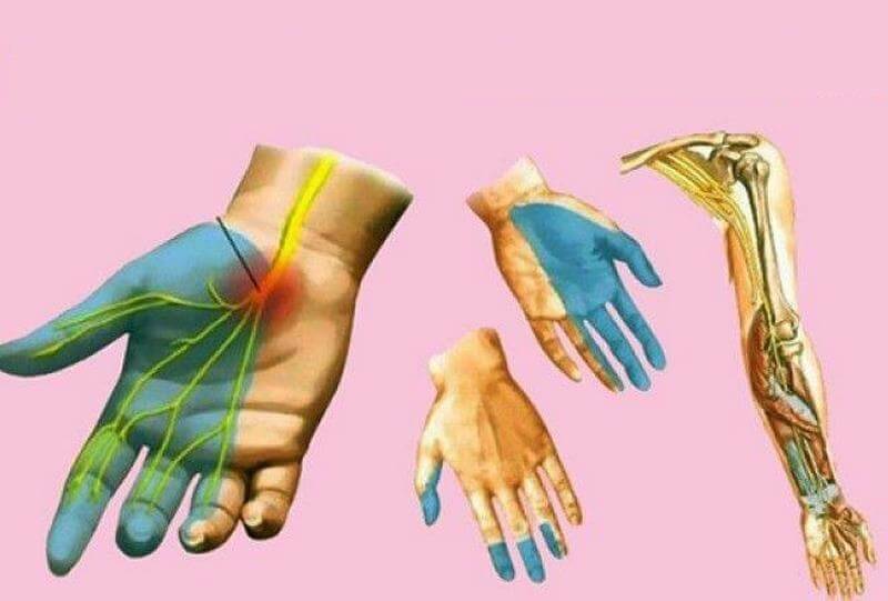 Почему немеют руки: 7 причин сходить к врачу