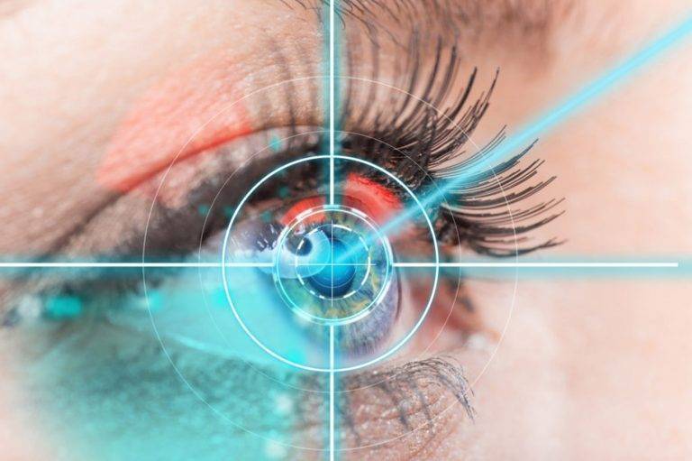 Почему важна лазерная коррекция зрения