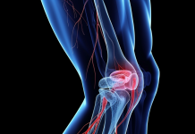 Диагностика тромбофлебита: когда и как её проводить для эффективного лечения
