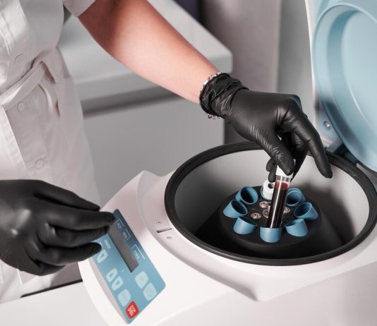 Центрифуга для плазмы крови: особенности оборудования
