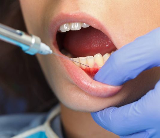 Прежде чем стоматолог сделает вам анестезию, он должен знать, от чего вы страдаете.