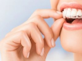 Элайнеры 3D Smile: комфортное и незаметное исправление прикуса без брекетов