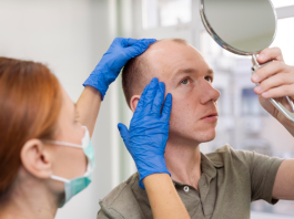 Пересадка бакенбардов: современный способ подчеркнуть мужской стиль