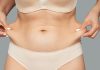 Подтяжка кожи после похудения